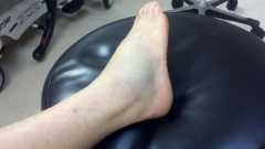 Reggies ankle