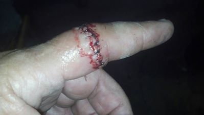 kurts finger